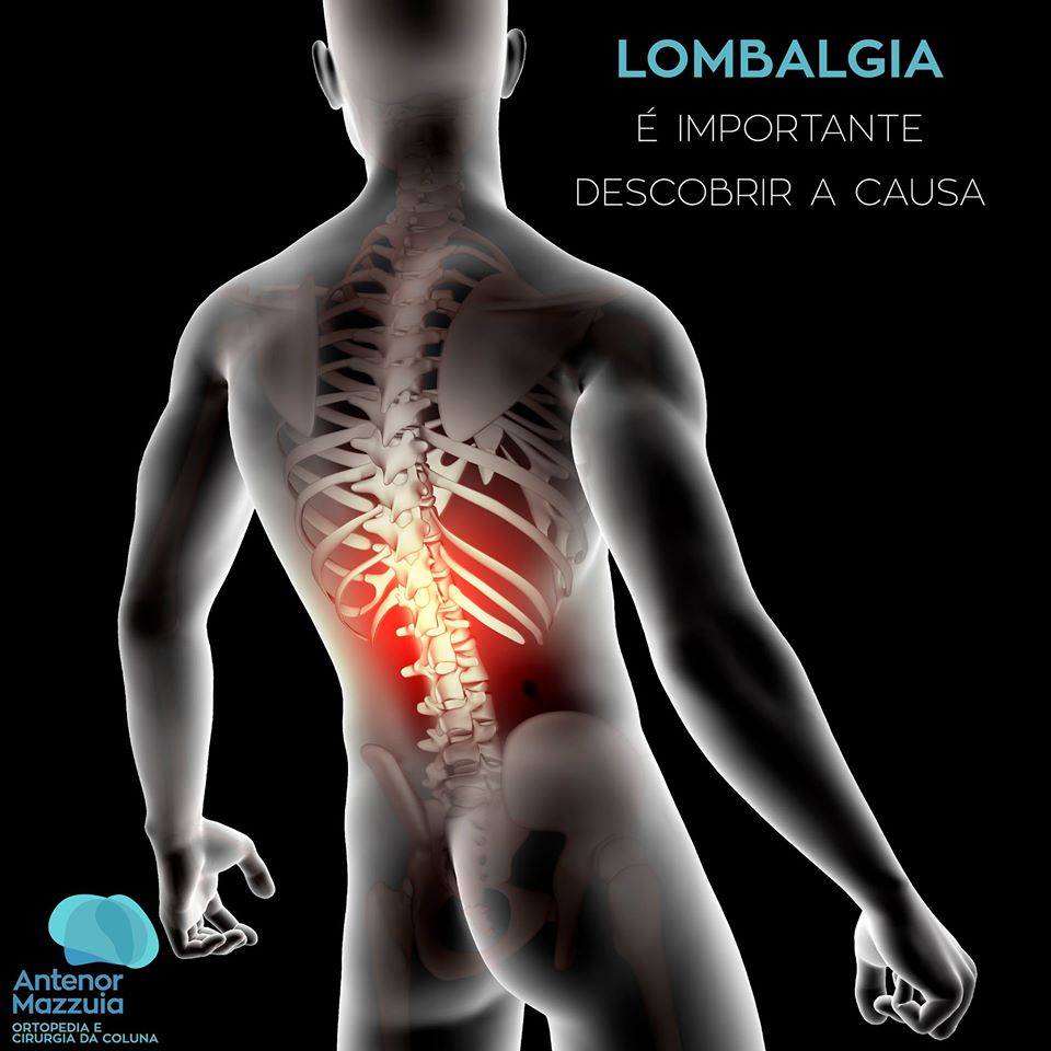 Lombalgia Importante Descobrir A Causa Antenor Mazzuia Ortopedia E Cirurgia Da