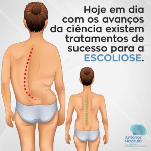 Dr. Antenor MazzuiaAntenor Mazzuia Ortopedia e Cirurgia da Coluna